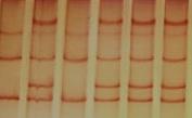 Gradient Gel Electrophoresis DHPLC - Denaturing High Performance Liquid