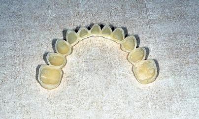 Wyzwania stomatologii estetycznej 35 36 Ryc. 35, 36.