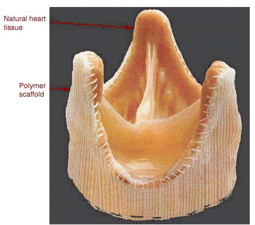 Allogenna zastawka