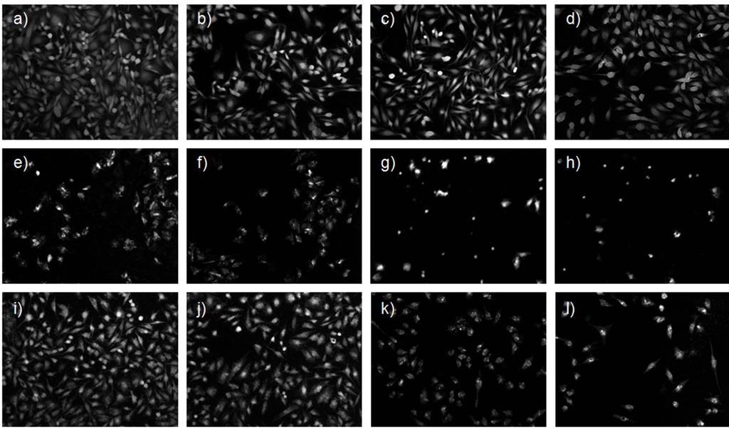 14 RYS. 5. Ocena zachowania komórek osteoblastopodobnych po 48 godzinach hodowli: bez kontaktu z biomateriałem (a), stal austenityczna 316L (b), Ti+V/mp (c), Ti+Nb/mp (d), Ti+V/s.200 (e), Ti+Nb/s.