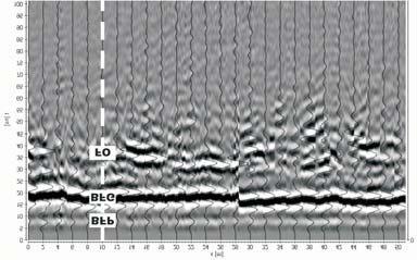 270 H. Marcak, T. Go³êbiowski & S. Tomecka-Suchoñ A) B) C) D) Fig. 8. Echogramy po przetwarzaniu z badañ nad Rudaw¹ dla ró nych rozstawów anten: A) 0.5 m; B) 1.0 m; C) 1.5 m; D) 2.0 m Fig. 8. Echograms after processing for measurements with various offset carried out in Rudawa site: A) 0.
