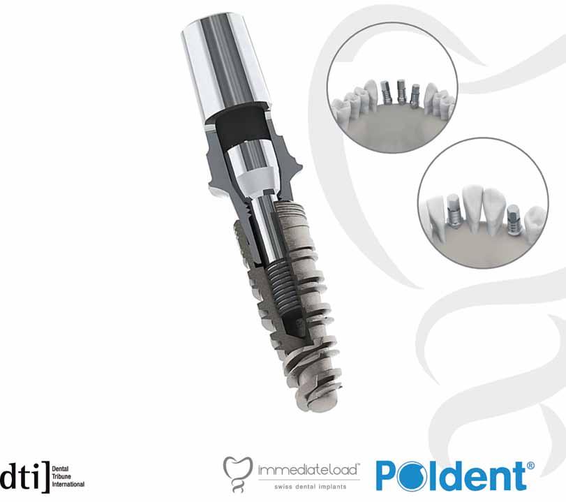 Vol. 10 2015 ISSN 1896-1444 Cena: 30 PLN (w tym 5% VAT) international magazine of oral implantology 3 2015 wydanie polskie