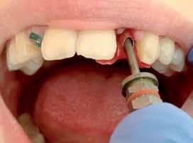 członek sądu koleżeńskiego Polskiego Towarzystwa Dysfunkcji Narządu Żucia. Ma rozpoczęty przewód doktorski w Klinice Periodontologii UM Lublin. Doktorat dotyczy siły utrzymania odbudowy na implancie.