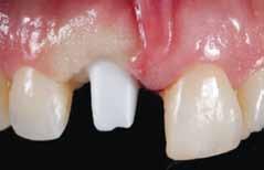 13b _autor Tommie Van de Velde, DDS, MSc, PhD uzyskał dyplom stomatologa, a później specjalisty