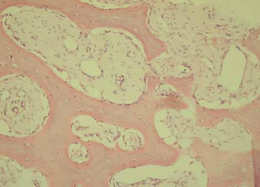 _chirurgia stomatologiczna Ryc. 6 w znieczuleniu ogólnym.