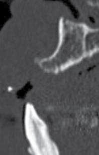 1_Baseline panoramic radiograph.
