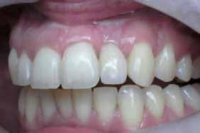 Dr Richard Marcelat has a DDS in Oral Implantology from the University of Liège and in Basal Implantology from the University of Nice Sophia
