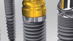 kościozastępcze i membrany (BEGO Implant Systems) _magazine TWÓJ