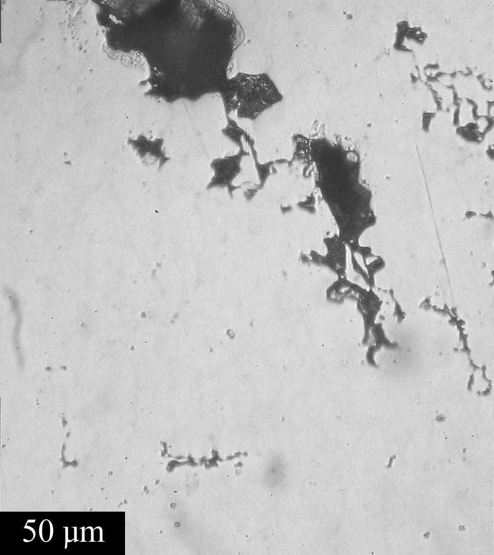 Porosity in die casting of AZ91D alloy