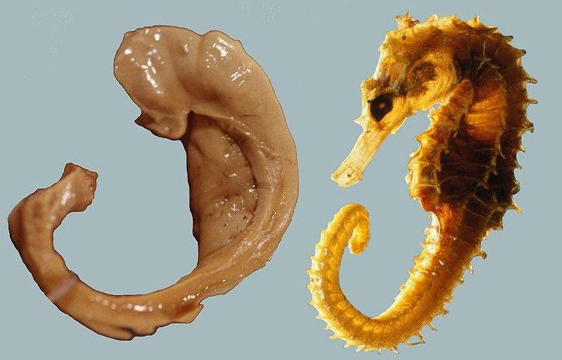 37 Kresomózgowie parzyste hipokamp (hippocampus), róg Ammona FUNKCJE