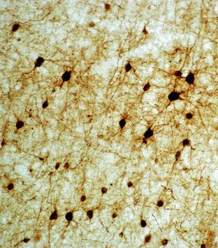 Koszyczkowe (basket cells) Granulowane (granule cells) Kresomózgowie parzyste kora mózgu 12