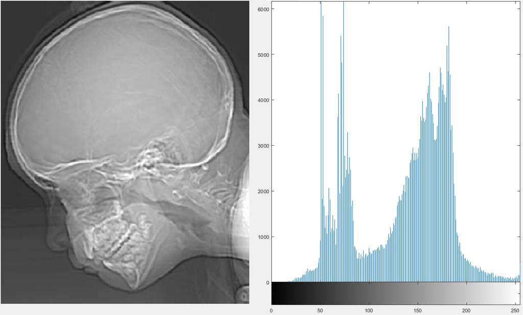 Histogram graf zobrazující kolik pixelů v obraze má jakou intenzitu osa x intenzita (většinou hodnoty 0-255) osa y