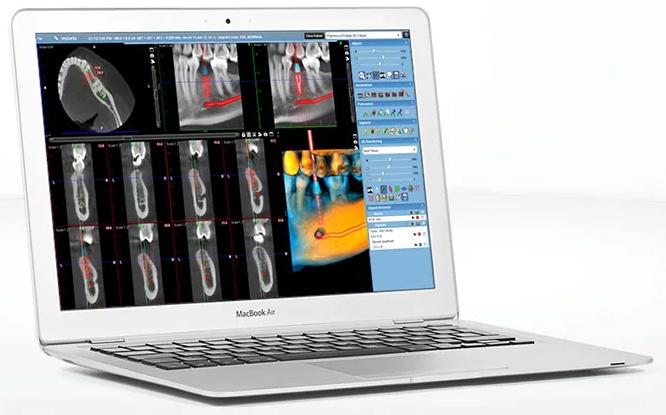 Planmeca Romexis Planmeca Romexis Viewer je bezplatná plnohodnotná aplikace pro prohĺıžení Planmeca 2D a 3D snímků flexibilní způsob, jak pomoci odborníkům a pacientům prohĺıžet klinické snímky