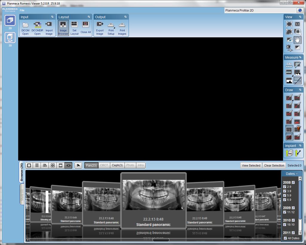 Planmeca Romexis viewer otevření snímku dvojklik na miniaturu úprava obrazu: nástroje prohĺıžení (viewing tools) nástroje měření