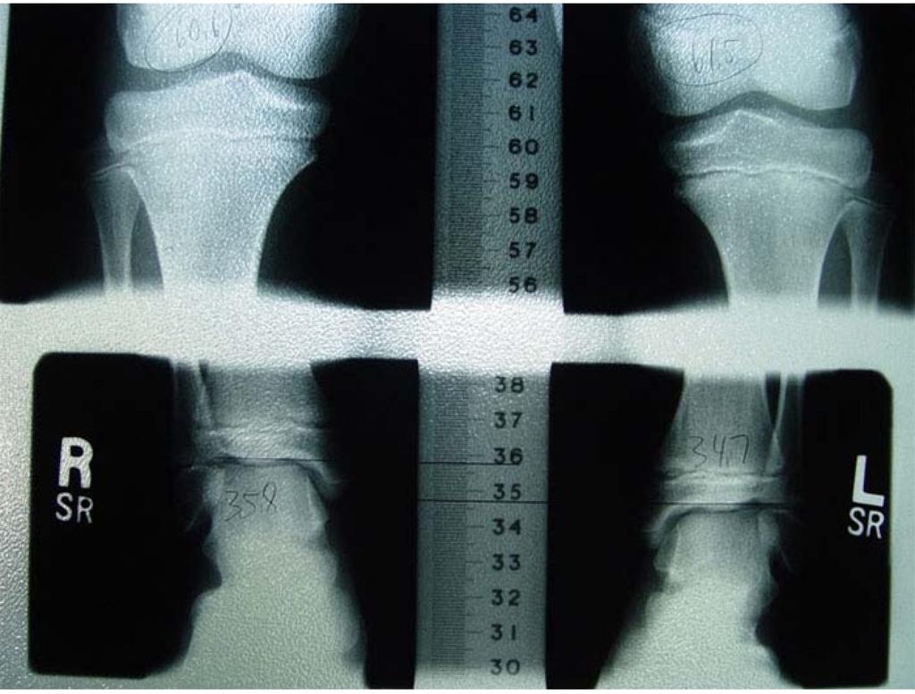 Měření měření vzdáleností v obraze dle vzdálenosti pixelů kalibrace nastavení skutečné velikosti potřebujeme nějaký