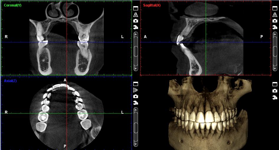 Prohĺıžeč 4 pohledy: Sagitální (červený) Koronální (zelený) Axiální (modrý) 3D objem barevné čáry přes obrazy roviny řezu 3 skupiny funkcí: