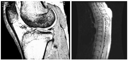 medicína a astronomie (MRI) zvuk