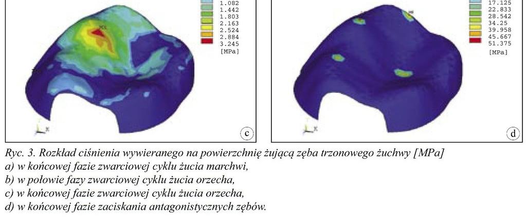 trzonowych podczas trójwymiarowej symulacji żucia i zaciskania zębów,
