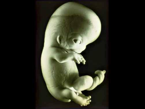 24 mm CS 22 embryo [EB] human embryo 7-8 wk [EB] 24 mm CS