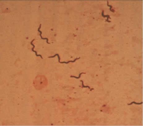 Taksonomia krętków Brachyspiraceae Leptospiracea Spirochaetaceae Brachyspira Leptonema Borrelia Leptospira