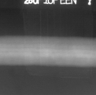 W przypadku kiedy liczba poziomów szarości użyta do zobrazowania pewnego detalu jest niezbyt duża jego obraz radiograficzny może wykazywać nieprzyjemną dla oka właściwość zwaną pikselizacją lub mniej