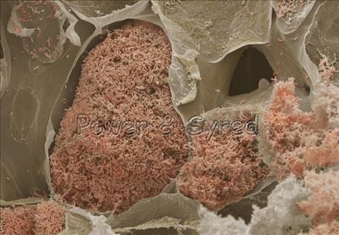 Bakterie z rodzaju Rhizobium w pękniętych