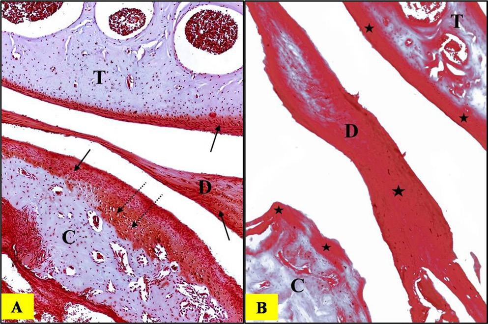 Dent Med Probl. 2018;55(4):359 366 363 and condyle. Areas of weak staining, appearing as an orange color, were observed in the condylar head, just beneath the fibrous covering (Fig. 4A).