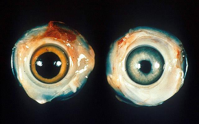 Marek s disease Left normal chicken eye.