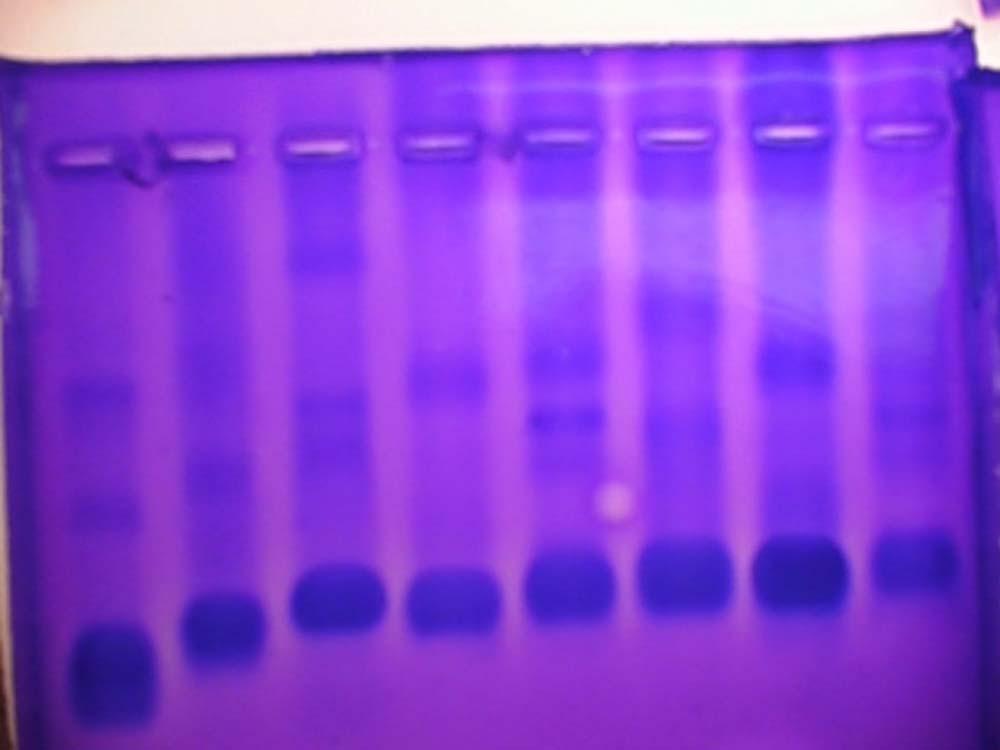 MODELOWANIE ELEKTROFOREZY DNA M.Krawczyk, P.Paściak, A.Dydejczyk, K.