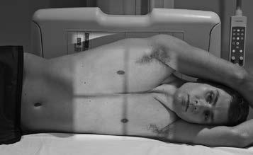 leżąca na boku 1 DECUB R Klatka piersiowa 35 43 cm (14 17 ) podłużnie w stosunku do pacjenta Kratka przeciwrozproszeniowa Ryc. 1.7 leżąca na lewym boku, zdjęcie klatki piersiowej w projekcji AP.