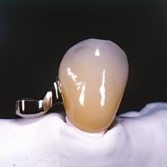 PRECI-POST CEKA SOL CEKALLOY CEKA SITE CEKA BOND 3C-BOND PERMA-RET PRECI-SEP PLASTICWAX EXPANDO extracoronal