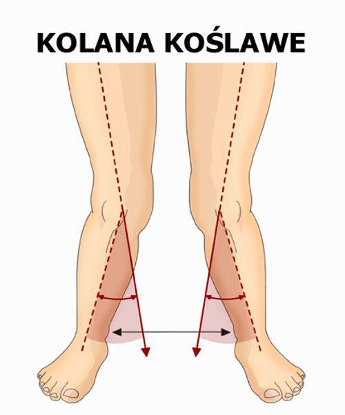 tworzy z osią uda kąt