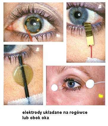 3-300Hz Impedancja wejściowa - >10MOhm CMRR -