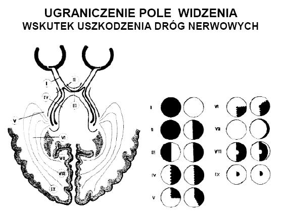 Pomiar pola widzenia (perymetria) Badanie pola widzenia wykazuje - dla każdego oka oddzielnie - ewentualne ubytki w polu widzenia.