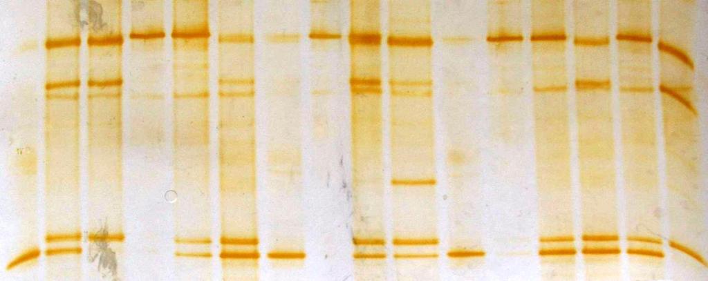 P. acidilactici KKP 1805 Zakwas po 24 h fermentacji Zakwas po 96 h fermentacji W. cibaria 7 Zakwas po 24 h fermentacji Zakwas po 96 h fermentacji P. acidilactici KKP 1805 W.