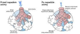 Badania diagnostyczne, dzieci <5 r.