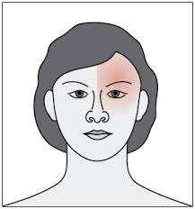 Konsekwencje urazu tępego oka Tępe urazy oka są związane z uderzeniem oka przez przedmiot lub inną osobę.