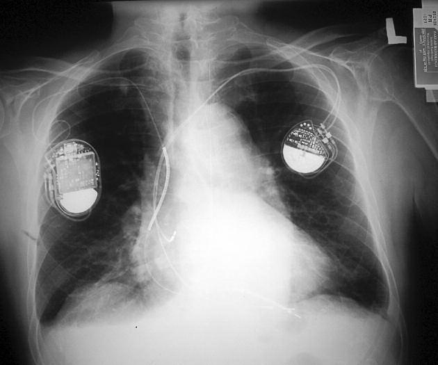 sure, central venous pressure and oxygen saturation monitoring during the whole procedure.