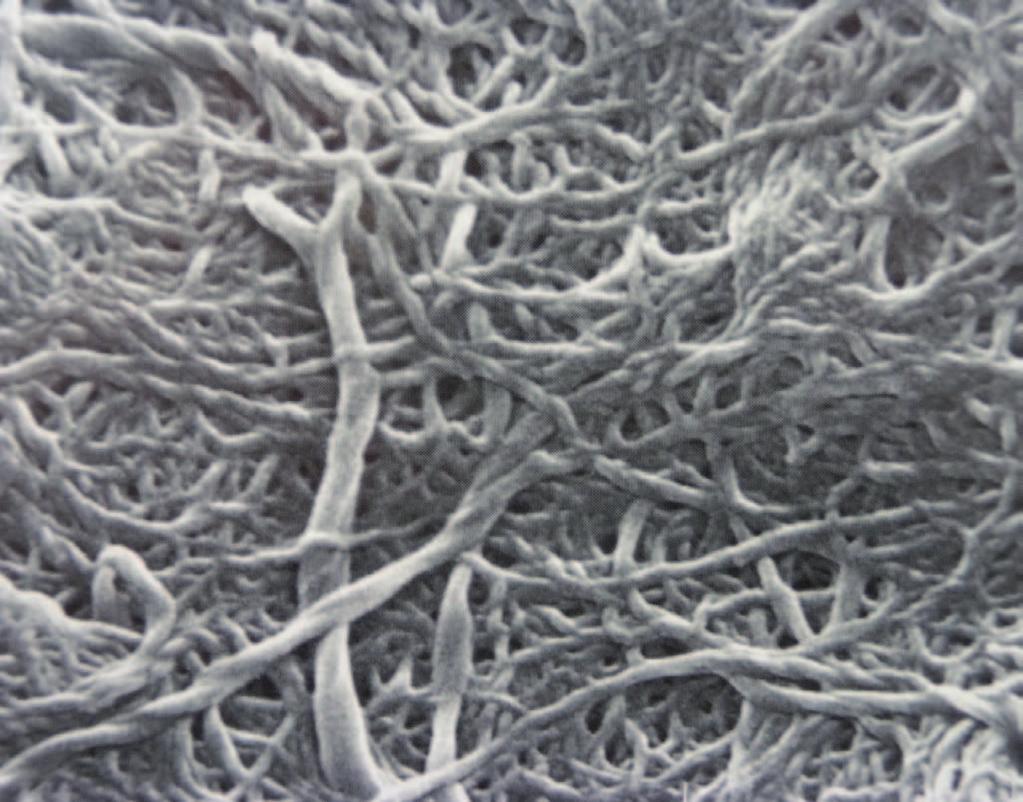 Biodegradowalne smary plastyczne Fot. 1.1. Struktura smaru litowego hydroksystearynowego (mikroskop elektronowy, powiększenie 20 000 ) Mydła sodowe tworzą długie włókna o rozmiarach do 100 µm.
