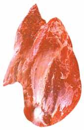 1500 i jest oddzielone anatomicznie wzdłuż naturalnych połączeń pomiędzy zrazową górną (2010) i zrazową dolną z ligawą