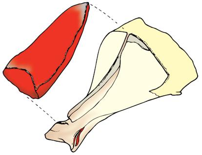 02 M. anconaeus 06 M. brachialis 08 M. coracobrachialis 11 M. deltoideus 14 M. extensor carpi radialis 36 M. infraspinatus 41 M. latissimus dorsi 84 M. subscapularis 86 M.