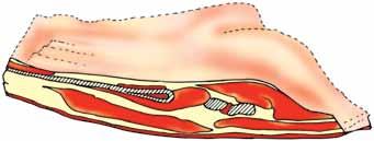 intertransversarius longus 43 M. longissimus cervicis 44 # Mm. longissimus capitis et atlantis 45 M. longissimus dorsi (syn. M longissimus thoracis et lumborum) 10 79 46 # M. longus capitis 67 47 # M.
