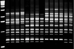 RAPD PCR PCR-RFLP genotyp -/- +/+ -/+ A T A T G C G C A T G C -/- +/+ -/+ Produkty PCR Trawienie specyficzną endonukleazą zastosowanie: diagnostyka PCR-RFLP wykrywanie: mutacje punktowe, insercje i