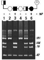 PCR RFLP SSCP polimorfizm konformacji jednoniciowych fragmentów DNA- Single Strand Conformation Polymorphism