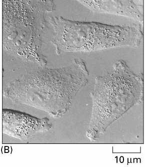 Komórki melanoma: (A)- niski poziom