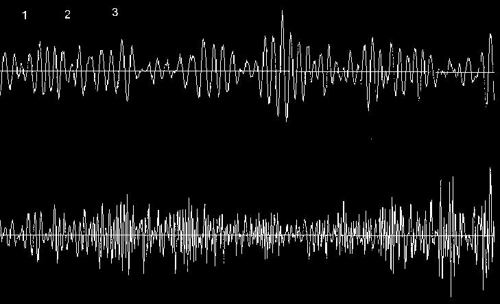 5[ sin( ω+ t) sin( ω t)] Qπ / 2 ( t) = 0.