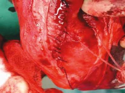 Warto raz jeszcze podkreślić, że bardzo pomocne jest preparowanie struktur okołorzepkowych na zwłokach i zaznajamianie się z włóknistymi elementami anatomicznymi.