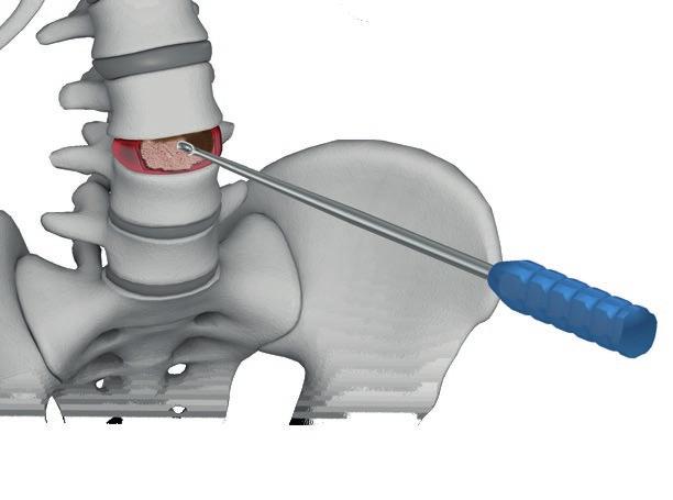 TECHNIKA OPERACYJNA IV.2.