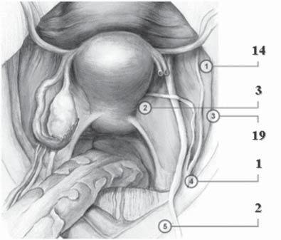 56 D. WYDRA, S. SAWICKI, J. EMERICH sentinel nodes that contained cancer cells was 39 (table 3, figure 4). In 23 (67.6%) of the patients the SLN was the only metastatic lymph node.