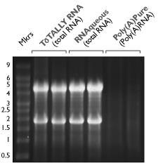 Test hybrydyzacyjny typu northern najprostsza metoda potwierdzenia, że odcinek DNA, który podejrzewamy, że jest